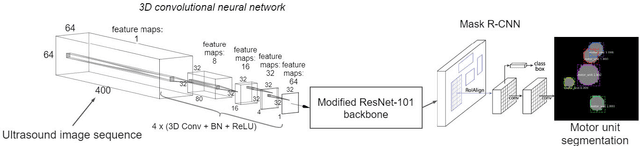 Figure 2 for A deep learning pipeline for identification of motor units in musculoskeletal ultrasound