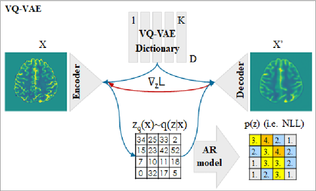 Figure 1 for Anomaly detection through latent space restoration using vector-quantized variational autoencoders