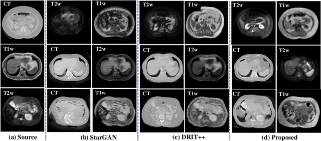 Figure 3 for Unified cross-modality feature disentangler for unsupervised multi-domain MRI abdomen organs segmentation