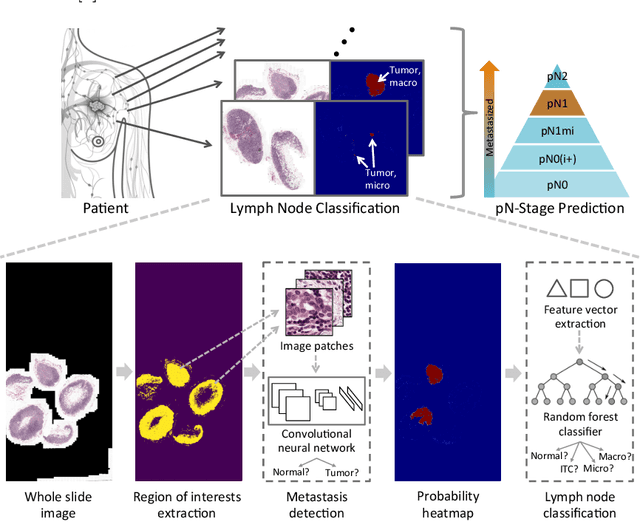 Figure 1 for A Robust and Effective Approach Towards Accurate Metastasis Detection and pN-stage Classification in Breast Cancer