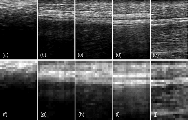 Figure 1 for A deep learning model for burn depth classification using ultrasound imaging