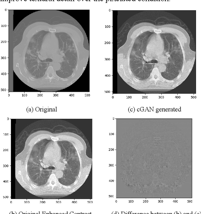 Figure 3 for Toward Generating Synthetic CT Volumes using a 3D-Conditional Generative Adversarial Network