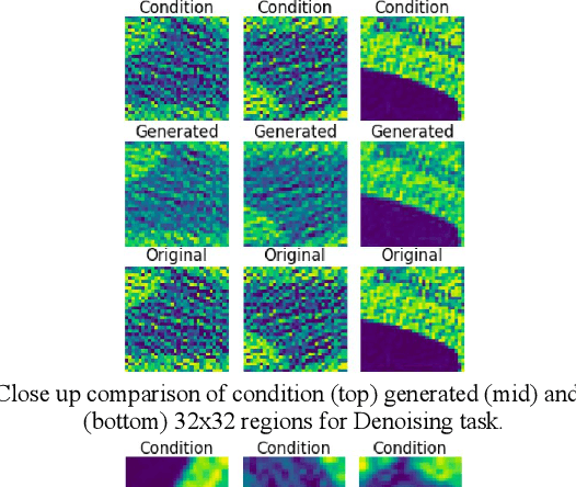Figure 4 for Toward Generating Synthetic CT Volumes using a 3D-Conditional Generative Adversarial Network