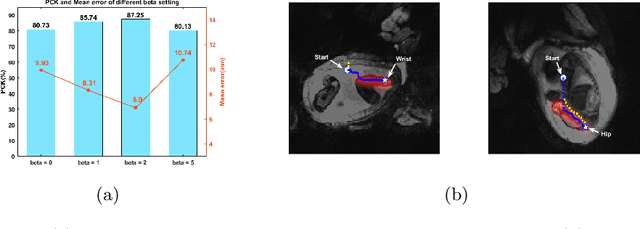 Figure 4 for Enhanced detection of fetal pose in 3D MRI by Deep Reinforcement Learning with physical structure priors on anatomy