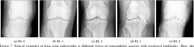 Figure 3 for KNEEL: Knee Anatomical Landmark Localization Using Hourglass Networks