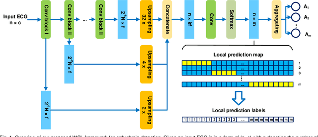 Figure 1 for Weakly Supervised Arrhythmia Detection Based on Deep Convolutional Neural Network