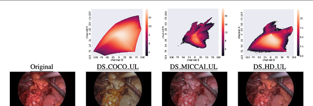 Figure 4 for Exploiting the potential of unlabeled endoscopic video data with self-supervised learning
