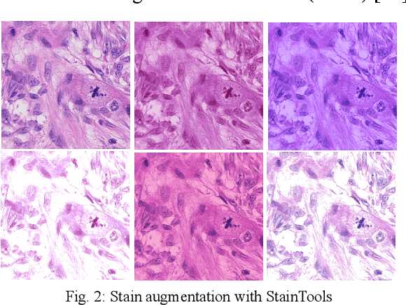 Figure 3 for Two-step Domain Adaptation for Mitosis Cell Detection in Histopathology Images