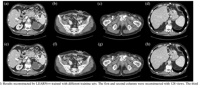 Figure 2 for LEARN++: Recurrent Dual-Domain Reconstruction Network for Compressed Sensing CT