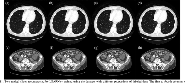 Figure 3 for LEARN++: Recurrent Dual-Domain Reconstruction Network for Compressed Sensing CT