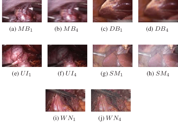 Figure 1 for Residual Networks based Distortion Classification and Ranking for Laparoscopic Image Quality Assessment