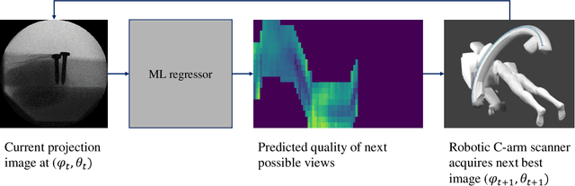 Figure 1 for A Learning-based Method for Online Adjustment of C-arm Cone-Beam CT Source Trajectories for Artifact Avoidance