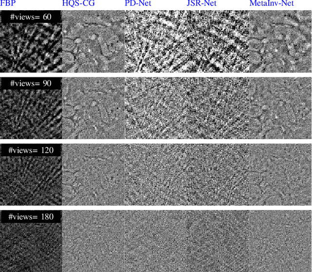 Figure 2 for MetaInv-Net: Meta Inversion Network for Sparse View CT Image Reconstruction