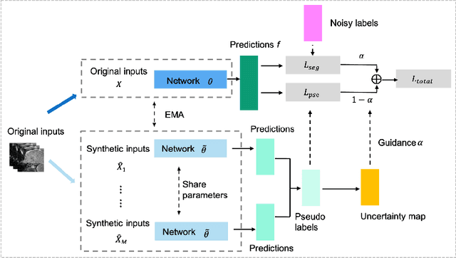 Figure 1 for Distilling effective supervision for robust medical image segmentation with noisy labels