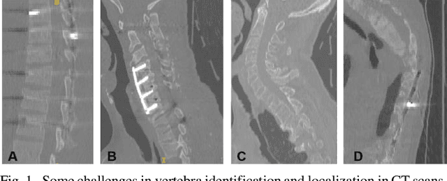 Figure 1 for Residual Block-based Multi-Label Classification and Localization Network with Integral Regression for Vertebrae Labeling