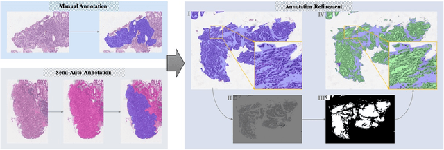 Figure 3 for Large-scale Gastric Cancer Screening and Localization Using Multi-task Deep Neural Network