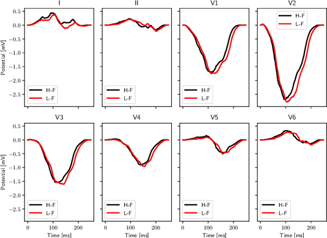 Figure 3 for Learning cardiac activation maps from 12-lead ECG with multi-fidelity Bayesian optimization on manifolds