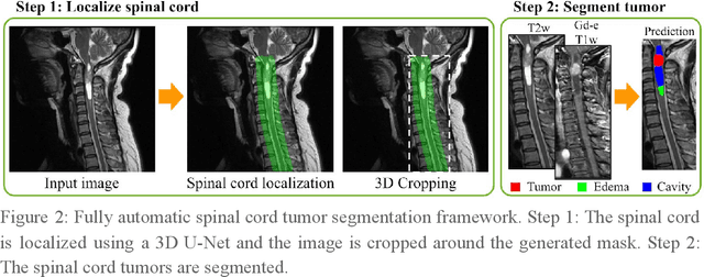 Figure 3 for Multiclass Spinal Cord Tumor Segmentation on MRI with Deep Learning