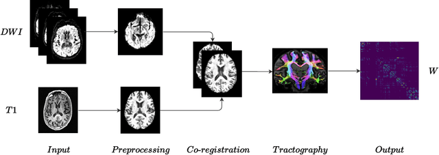 Figure 1 for Ensembling complex network 'perspectives' for mild cognitive impairment detection with artificial neural networks