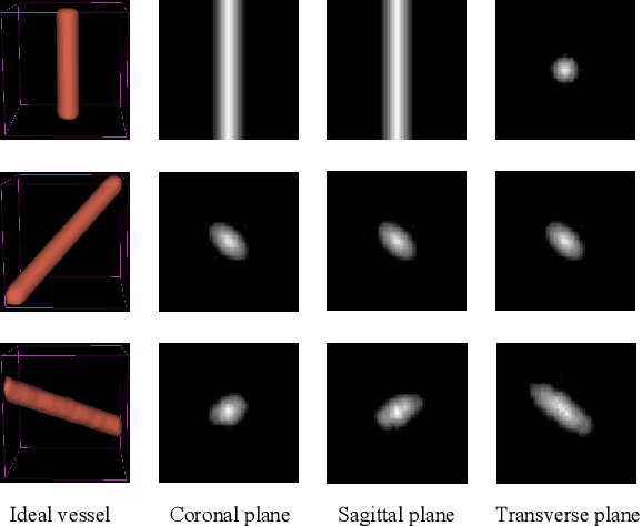 Figure 4 for Cerebrovascular Segmentation via Vessel Oriented Filtering Network