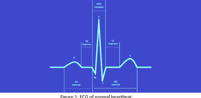 Figure 1 for Atrial Fibrillation: A Medical and Technological Review