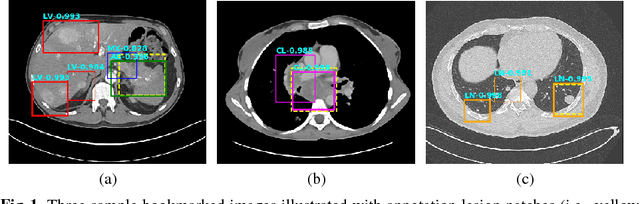 Figure 1 for DeepLesion: Automated Deep Mining, Categorization and Detection of Significant Radiology Image Findings using Large-Scale Clinical Lesion Annotations