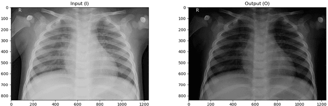 Figure 3 for An Approach to Intelligent Pneumonia Detection and Integration