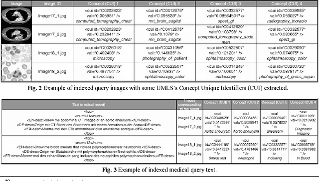Figure 4 for Prospective Study for Semantic Inter-Media Fusion in Content-Based Medical Image Retrieval