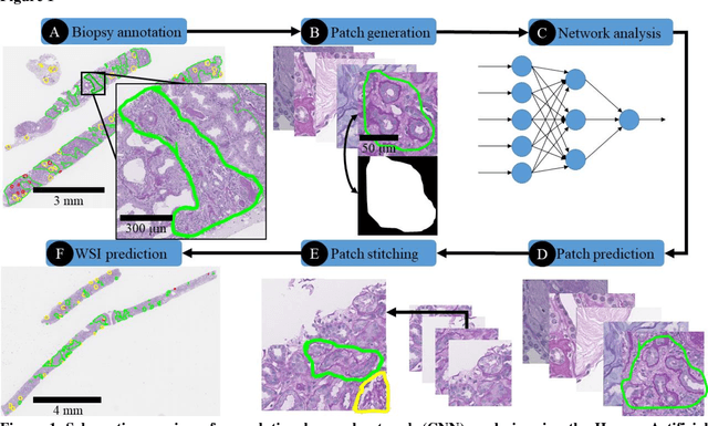 Figure 2 for Neural Network Segmentation of Interstitial Fibrosis, Tubular Atrophy, and Glomerulosclerosis in Renal Biopsies