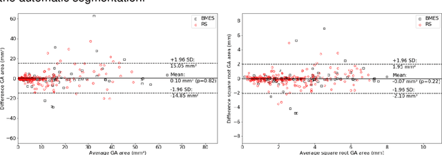 Figure 2 for A deep learning model for segmentation of geographic atrophy to study its long-term natural history