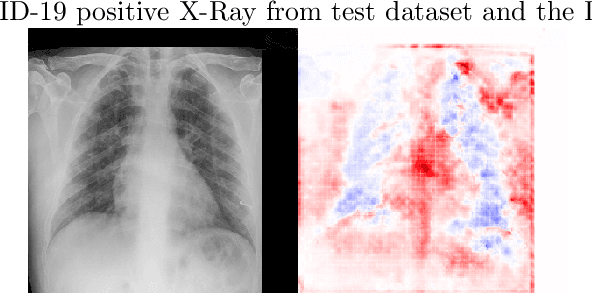 Figure 2 for A Deep Convolutional Neural Network for COVID-19 Detection Using Chest X-Rays