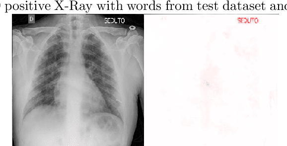Figure 4 for A Deep Convolutional Neural Network for COVID-19 Detection Using Chest X-Rays