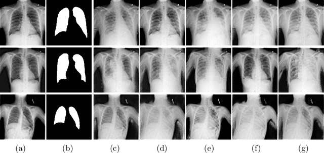 Figure 3 for XLSor: A Robust and Accurate Lung Segmentor on Chest X-Rays Using Criss-Cross Attention and Customized Radiorealistic Abnormalities Generation