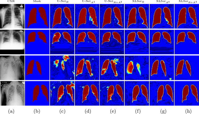 Figure 4 for XLSor: A Robust and Accurate Lung Segmentor on Chest X-Rays Using Criss-Cross Attention and Customized Radiorealistic Abnormalities Generation