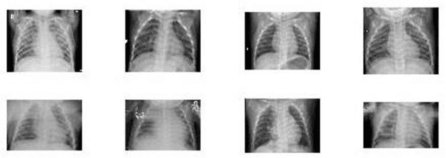 Figure 1 for A Critic Evaluation of Methods for COVID-19 Automatic Detection from X-Ray Images