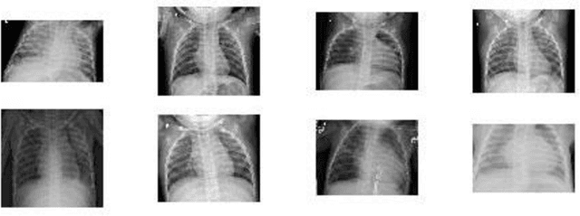 Figure 3 for A Critic Evaluation of Methods for COVID-19 Automatic Detection from X-Ray Images
