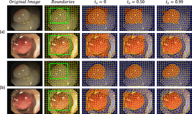 Figure 1 for BoxShrink: From Bounding Boxes to Segmentation Masks