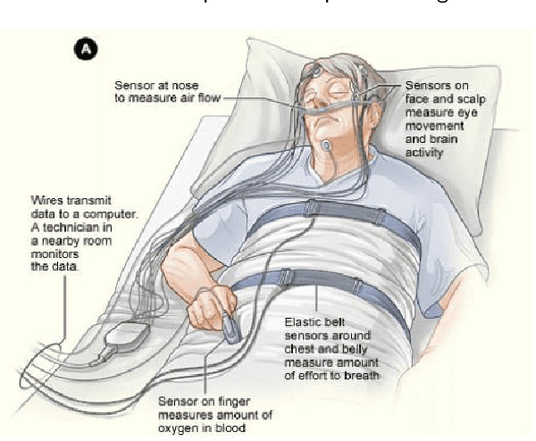 Figure 3 for A Review of the Non-Invasive Techniques for Monitoring Different Aspects of Sleep