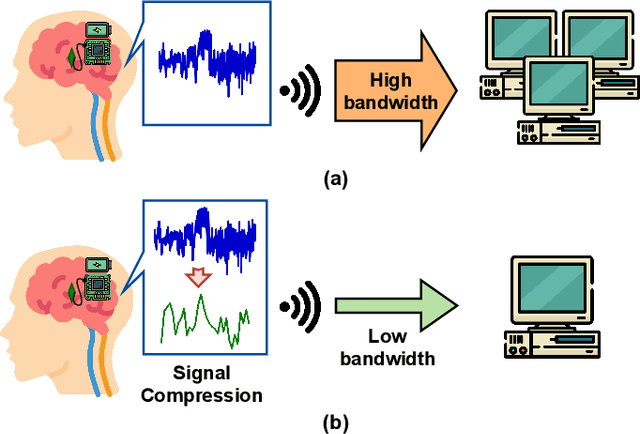 Figure 1 for C$^2$SP-Net: Joint Compression and Classification Network for Epilepsy Seizure Prediction