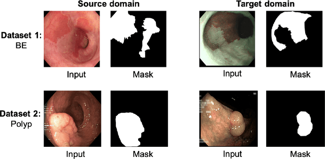 Figure 1 for EndoUDA: A modality independent segmentation approach for endoscopy imaging