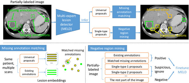 Figure 1 for Universal Lesion Detection by Learning from Multiple Heterogeneously Labeled Datasets