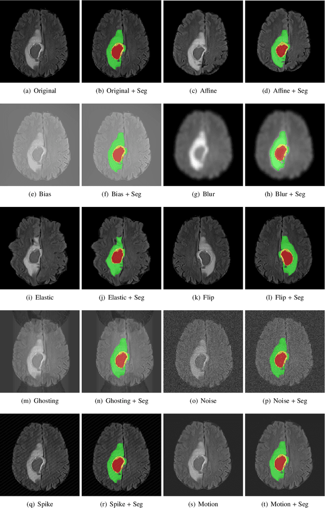 Figure 3 for GaNDLF: A Generally Nuanced Deep Learning Framework for Scalable End-to-End Clinical Workflows in Medical Imaging