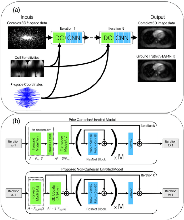 Figure 3 for Reconstruction of Undersampled 3D Non-Cartesian Image-Based Navigators for Coronary MRA Using an Unrolled Deep Learning Model