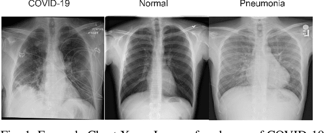 Figure 1 for COVID-19 Detection in Chest X-ray Images Using Swin-Transformer and Transformer in Transformer
