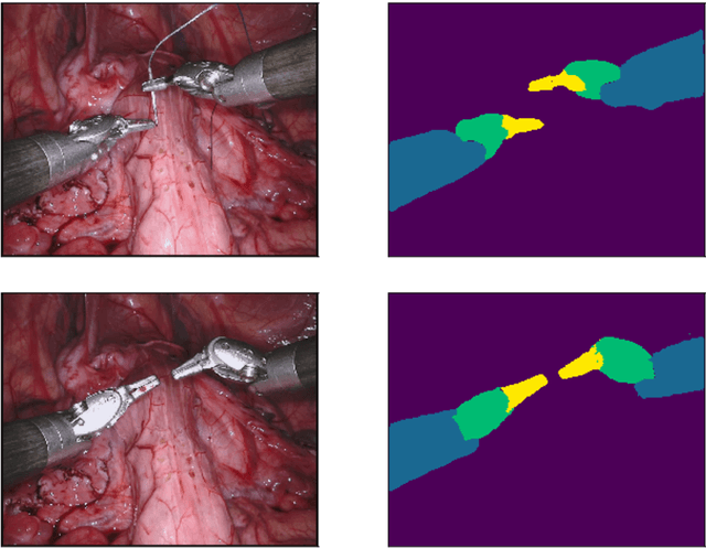 Figure 1 for Searching for Efficient Architecture for Instrument Segmentation in Robotic Surgery