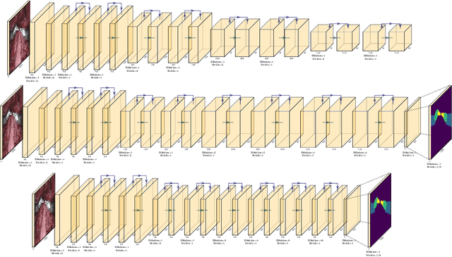 Figure 3 for Searching for Efficient Architecture for Instrument Segmentation in Robotic Surgery