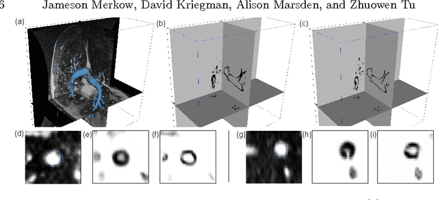 Figure 2 for Dense Volume-to-Volume Vascular Boundary Detection