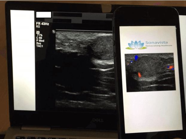 Figure 1 for On-demand teleradiology using smartphone photographs as proxies for DICOM images