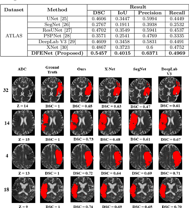 Figure 4 for DFENet: A Novel Dimension Fusion Edge Guided Network for Brain MRI Segmentation