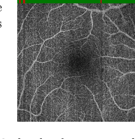 Figure 4 for Deep OCT Angiography Image Generation for Motion Artifact Suppression